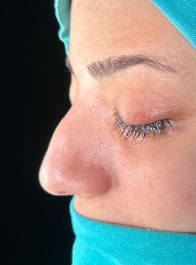 before-img1